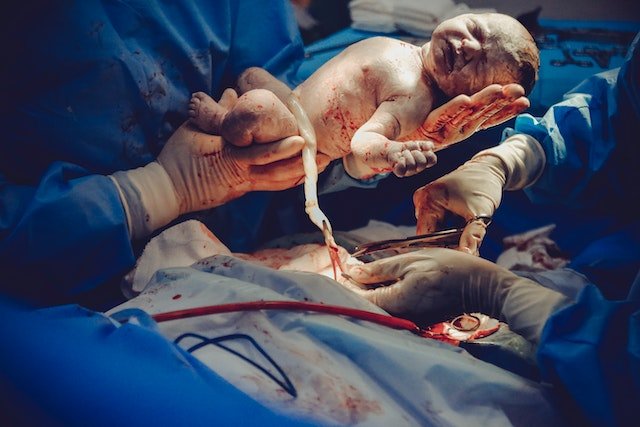 Baby Born with Cord Around Neck Spiritual Meaning