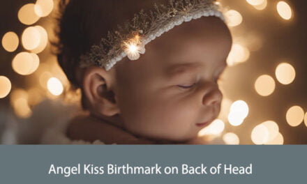 Angel Kiss Birthmark on Back of Head Spiritual Meaning